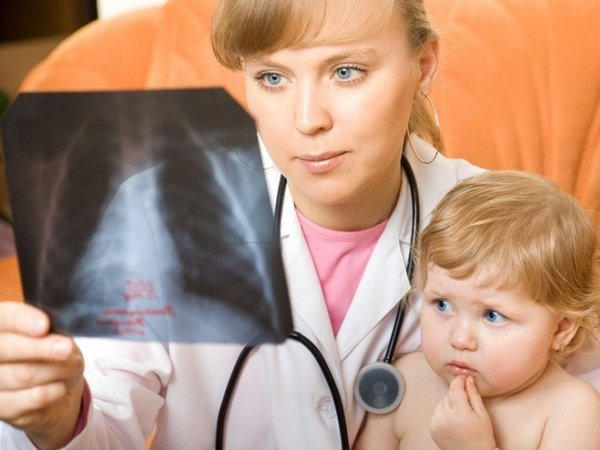 В Покровске резко возросло количество детей, заболевших пневмонией
