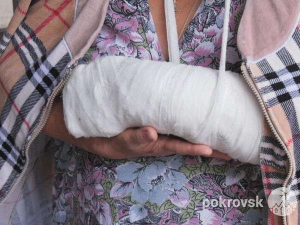 После нападения стаи собак жительница Покровска оказалась в травматологии