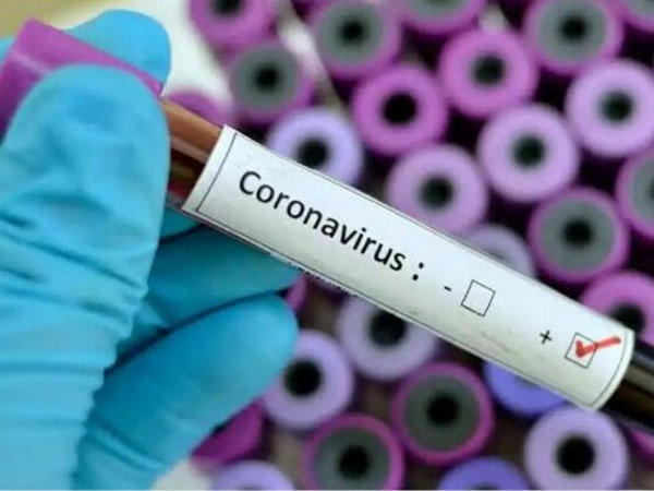 В больницу Селидово доставят оборудование для борьбы с эпидемией коронавируса
