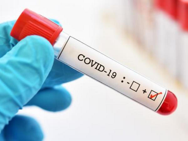 В Донецкой области подтверждено два новых случая коронавируса