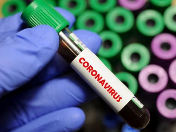 В Донецкой области выявлен 81 случай COVID-19, в том числе в Селидово, Новогродовке и Покровске