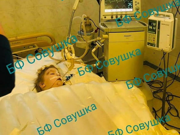 Двухлетний ребенок из Горняка, которого покусали собаки, скончался в больнице Днепра