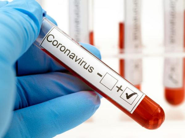 В Донецкой области выявлено 433 новых случая COVID-19, из которых 14 - в Селидовской, Новогродовской и Покровской ОТГ