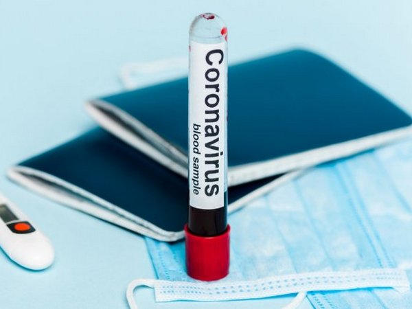 В Новогродовке выявлены новые случаи COVID-19