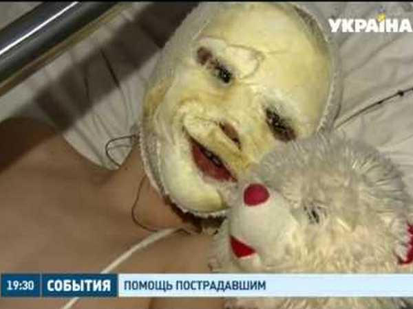 Как лечатся пострадавшие в результате взрыва в Украинске