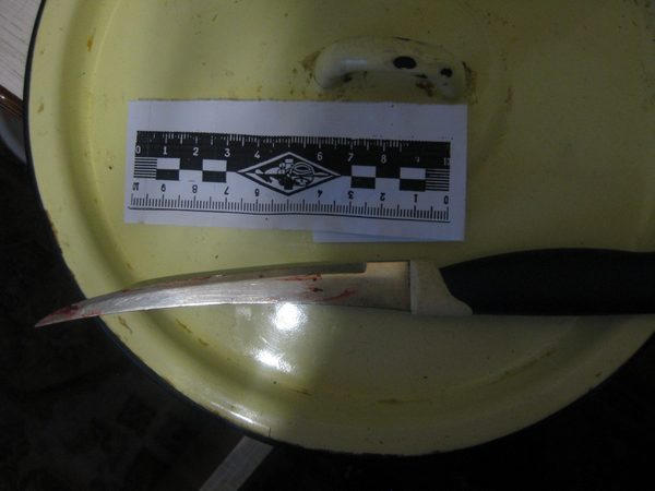 В Украинске во время застолья хозяйка вонзила нож гостю в живот