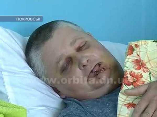 В Покровском районе парня и его отца жестоко избили за фразу «Слава Украине!»