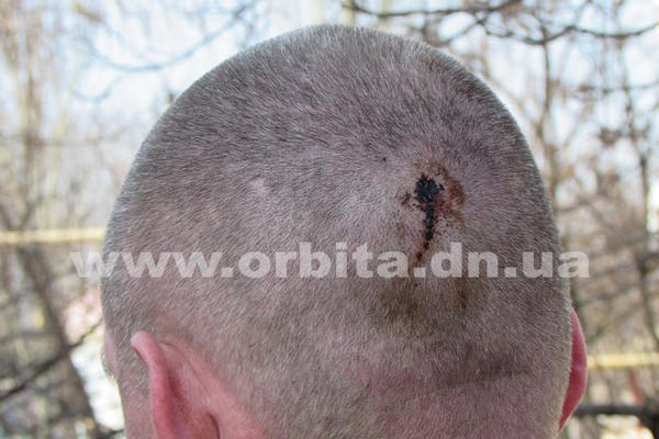 Полицейский из Киева устроил стрельбу и пытался убить человека в Мирнограде