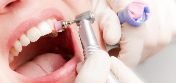 Рекомендации и советы по отбеливанию зубов
