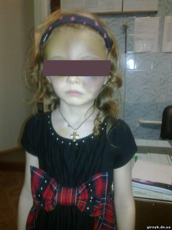 В Донецке мать жестоко избила свою семилетнюю дочь (фото + видео)