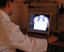 В Селидово появилась современная лаборатория по диагностике туберкулеза (видео)