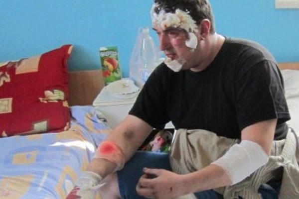 Как чувствуют себя спасатели, пострадавшие во время взрыва в Красноармейске