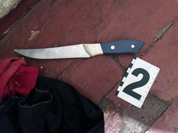 Житель Мирнограда ударил свою любимую ножом в живот