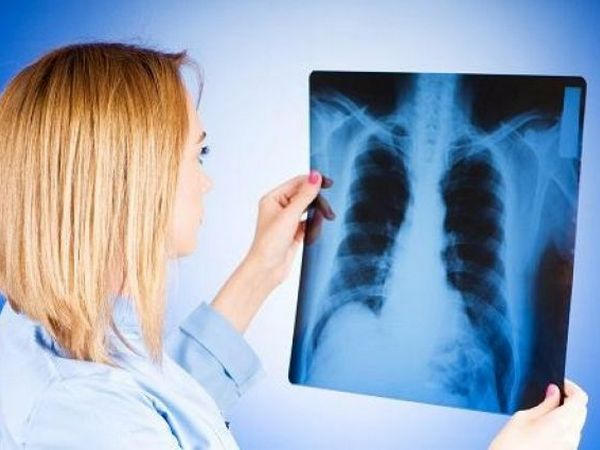 Донетчина шокирует ростом уровня заболеваемости туберкулезом