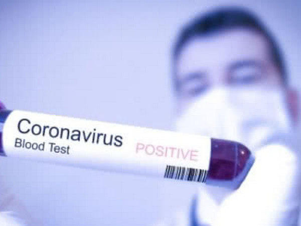 В Украине официально зафиксирован первый случай заболевания коронавирусом