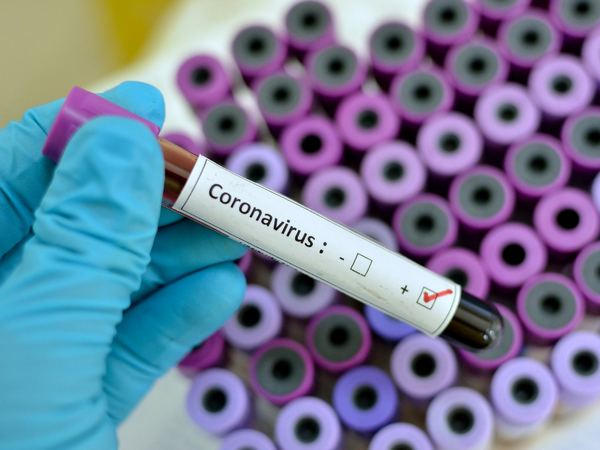 Донецкая область не получит тест-системы для выявления коронавируса