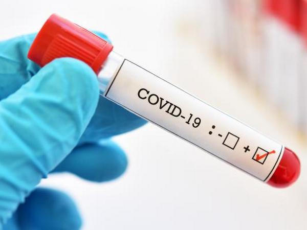 В Донецкой области зафиксированы уже 11 случаев заболевания коронавирусом COVID-19
