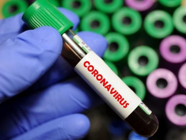 За сутки в Донецкой области зафиксировано 84 новых случая COVID-19 и одна смерть от коронавируса