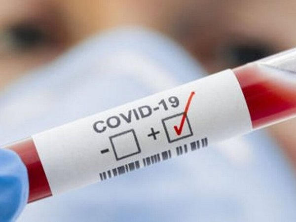 В Донецкой области зафиксировано 50 новых случаев COVID-19 и четыре смерти от коронавируса