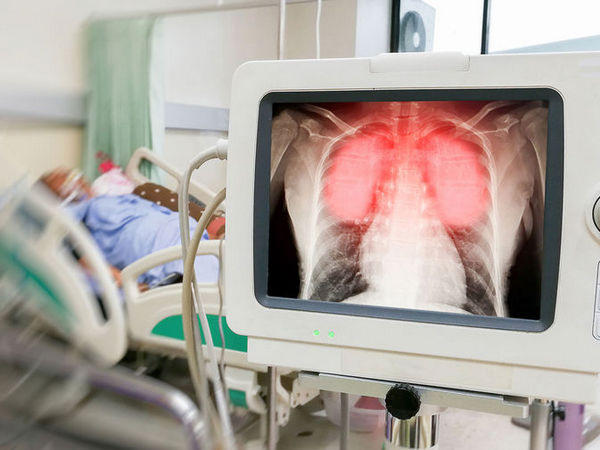 В инфекционном отделении Покровской больницы массово умирают больные с пневмонией